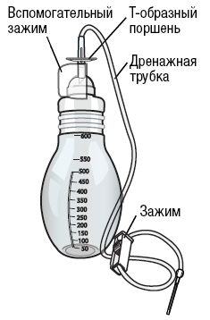 Рисунок 3.  Вакуумная банка