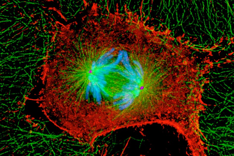 A cell in the process of dividing