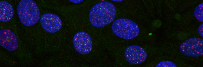 Blue cells containing small red dots on a green and black background