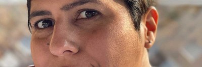 Photo of Hispanic patient who had metaplastic breast cancer.