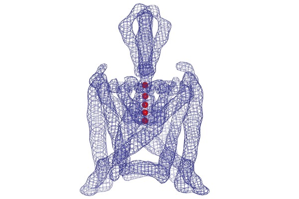 Pictured: Two mesothelioma cells connected by long extensions called tunneling nanotubes, which potentially may be a conduit for communication between the cells.