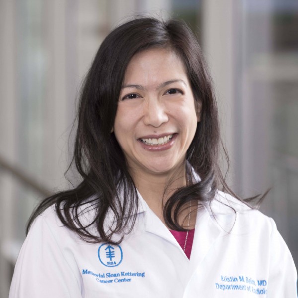 Memorial Sloan Kettering radiologist Kristin Belen